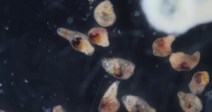 Freshwater Trematode Parasites: Clinostomum, Postorchigenes and Thapariella spp. for education in Lab.