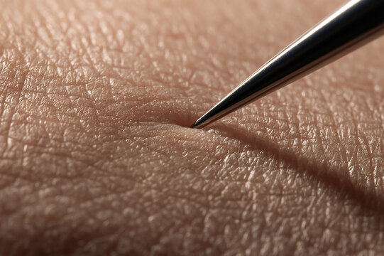 Ultra-macro photo of a steel needle tip touching human skin
