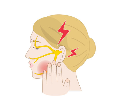 Profile Illustration of a white woman with Trigeminal Neuralgia Feeling Facial Pain