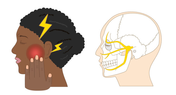 Comparison Diagram of Black woman Experiencing Trigeminal Neuralgia and a Human Skull