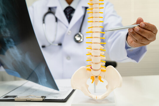 Doctor examining spine bone radiography xray film.