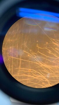 Fungal culture