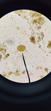 parasite egg