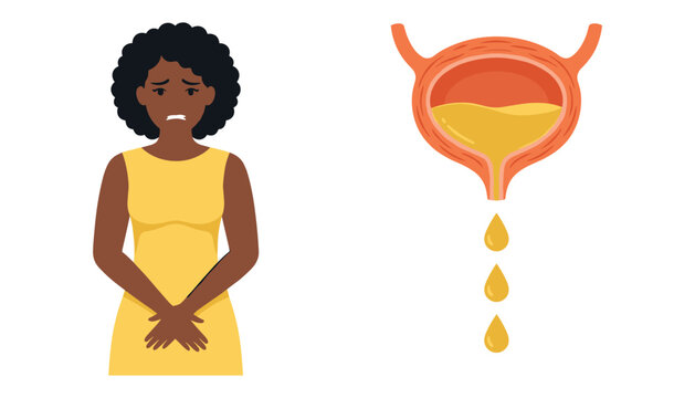 Sad African American woman experiencing urinary incontinence with bladder anatomy diagram and dripping urine drops vector illustration