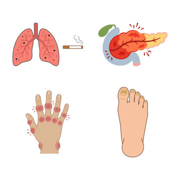 Medical Conditions and Human Anatomy Health Illustrations Set Showing Disease Impacts