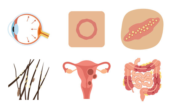 Set of medical vector icons showing human internal organs and various common health conditions symptoms