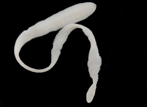 Scientific collection of freshwater trematode parasites, including Clinostomum spp., Postorchigenes sp., and Thapariella sp. These parasitic flatworms have complex life cycles involving multiple hosts