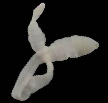 Scientific collection of freshwater trematode parasites, including Clinostomum spp., Postorchigenes sp., and Thapariella sp. These parasitic flatworms have complex life cycles involving multiple hosts