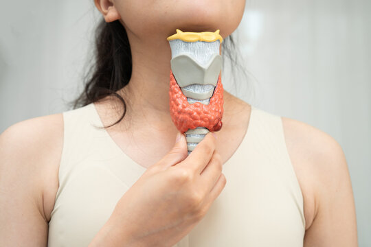 Hyperthyroidism, Overactive Thyroid, Thyroid Lymphoma, Asian woman with thyroid gland human anatomy model.