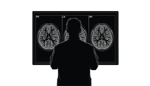 Doctor reviewing detailed brain MRI scans on a digital screen shown as a back view silhouette on white background.