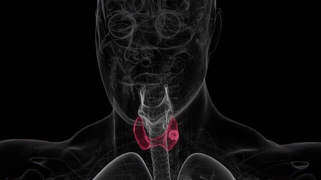 Thyroid cancer is a malignant tumor arising from cells of the thyroid gland, a hormone-producing organ located at the front of the neck in 4K UHD