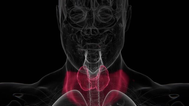 Goiter is an enlargement of the thyroid gland that can occur due to thyroid dysfunction, iodine deficiency, autoimmune conditions, or other underlying causes in 4K Video
