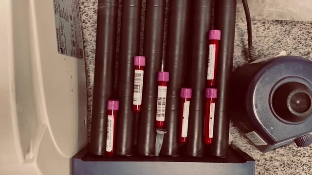 Blood samples in laboratory mixer for medical diagnostic testing