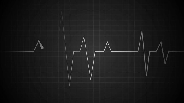 Ekg style line graph on a grid background with glowing peaks and dips animation, Heartbeat pulse signal and data chart concepts