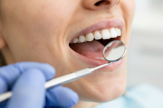 Dentist examining patient teeth with dental mirror in clinic
