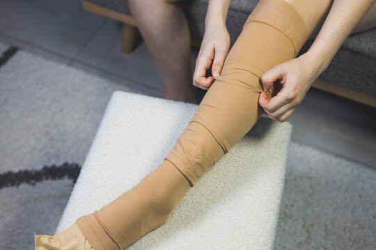 Woman pulling up and adjusting a beige medical compression stocking on her leg. Close up.
