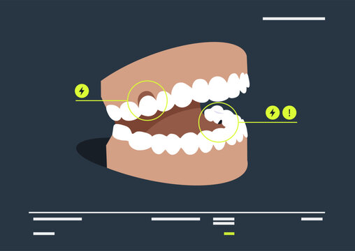 Colorful graphics reveal the anatomy of teeth problems, highlighting key structures and functions in a creative and informative way for educational purposes