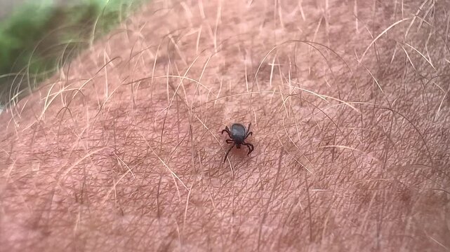 Tick crawls on a man's hand. Tick crawling along a person's hand. Encephalitis mite. Tick-borne encephalitis (TBE) is a viral infection spread by tick bites. Fatal diseases from tick bites