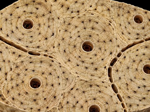 3D histological cross-section of compact bone at 200x &mdash; complete Haversian osteon units with concentric lamellae, central canals, osteocyte lacunae, canaliculi threads, and Volkmann's canals
