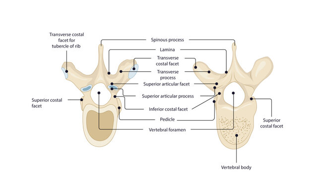 Thoracic and Lumbar vertebrae, Anatomical illustration comparing thoracic and lumbar vertebrae with their major bony landmarks.