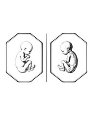 Fototapeta premium Comparative anatomical study of a human fetus in fetal position showing external form and internal skeletal structure within decorative octagonal frames in vintage style