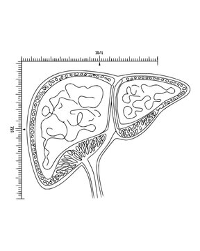 Technical schematic illustration of a human liver featuring precise border measurements and internal structural outlines for medical documentation and anatomical analysis