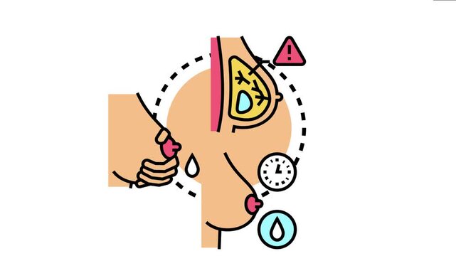 Woman's breast anatomy illustrating common breastfeeding challenges including mastitis, blocked ducts, engorgement, and milk supply issues
