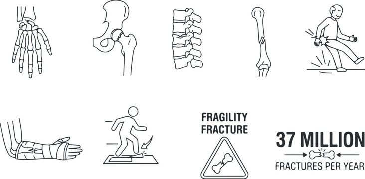 Human skeleton parts and fracture illustrations showing hand, hip, spine, broken bone, and falling injury.