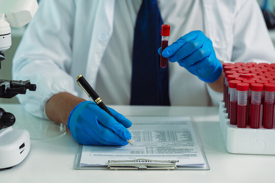 Scientist Holding Blood Sample Test Tube with Microscope and Rack of Blood Vials in Medical Laboratory