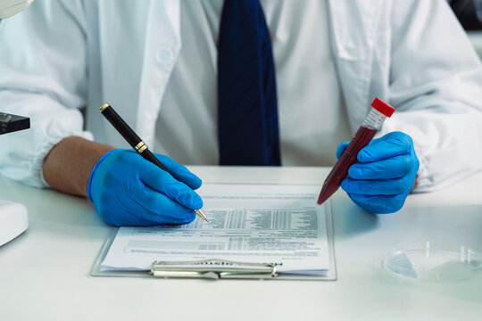 Scientist Holding Blood Sample Test Tube with Microscope and Rack of Blood Vials in Medical Laboratory