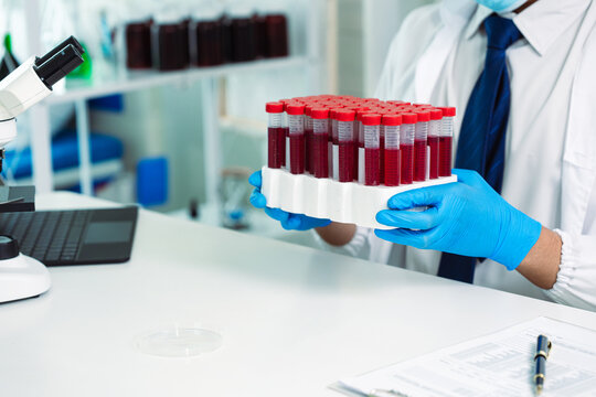 Scientist Holding Blood Sample Test Tube with Microscope and Rack of Blood Vials in Medical Laboratory