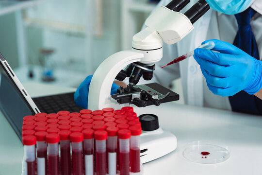 Scientist Holding Blood Sample Test Tube with Microscope and Rack of Blood Vials in Medical Laboratory