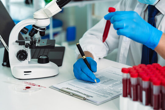 Scientist Holding Blood Sample Test Tube with Microscope and Rack of Blood Vials in Medical Laboratory