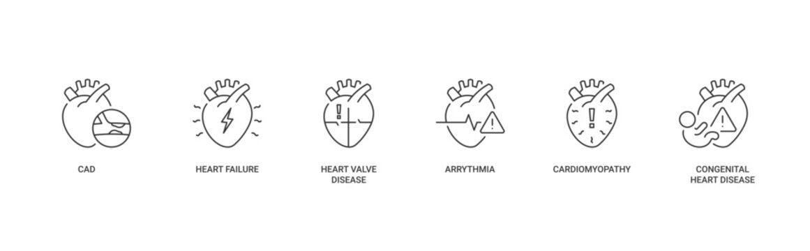 Types of Heart Disease icon set containing CAD, heart failure, heart valve disease, arrhythmia, cardiomyopathy and congenital heart disease vector concept illustration with simple icon