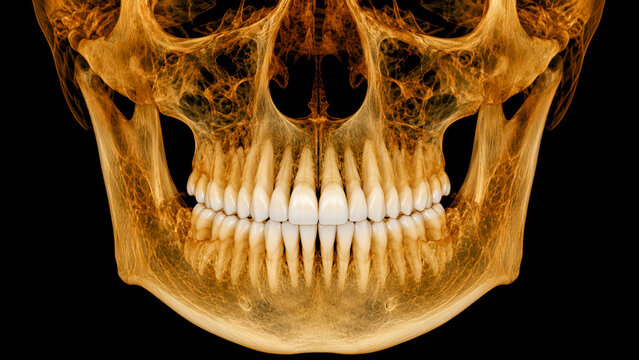 Dental CBCT scan 3D reconstruction of jaw teeth roots and facial bones for precise dentistry diagnostic imaging procedure
