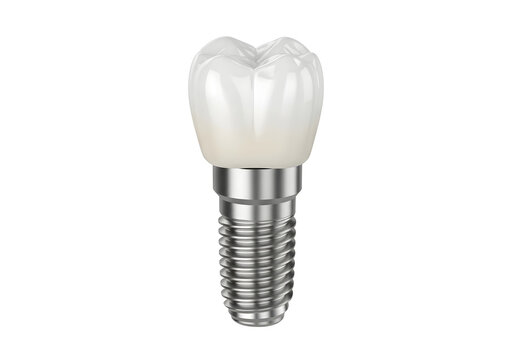 Dental implant with ceramic tooth crown isolated on white background