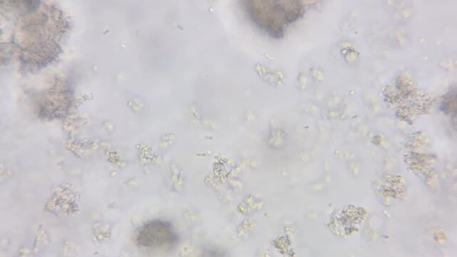Yogurt bacteria under microscope: Lactobacillus bulgaricus and Streptococcus thermophilus probiotics 