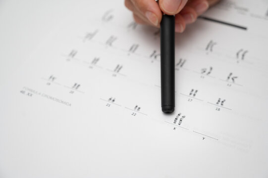 Hand analyzing human karyotype with chromosomes