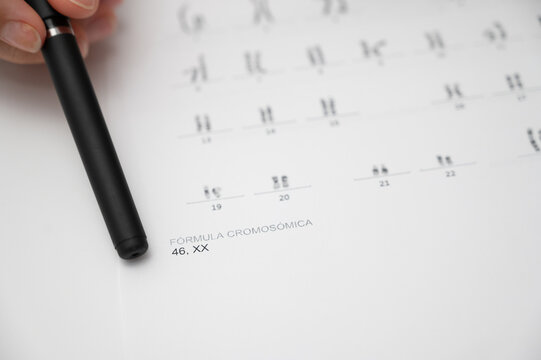 Examining karyotype results showing female chromosomal formula 46, XX