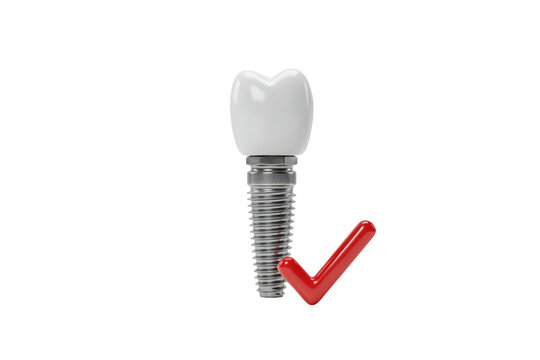 A single white dental implant with a metallic screw base positioned next to a bright red check mark symbol on a solid black background, 3d render