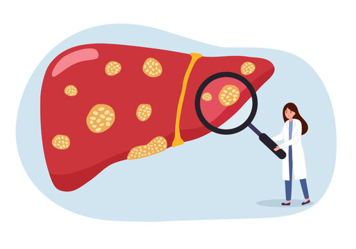 Doctor with magnifying glass examine infected Liver disease vector illustration