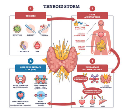 Thyroid storm brief overview maps triggers, symptoms, and therapy, thyroid gland, heart, and brain highlight the cascade for clinicians. Outline diagram