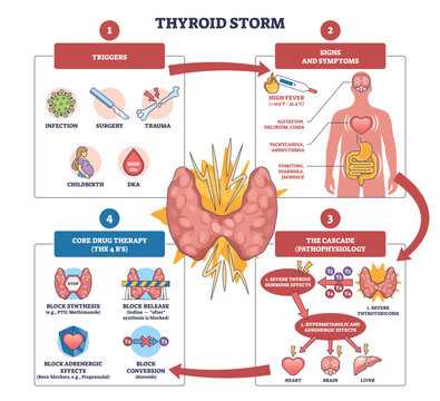 Thyroid storm brief overview maps triggers, symptoms, and therapy, thyroid gland, heart, and brain highlight the cascade for clinicians, transparent background