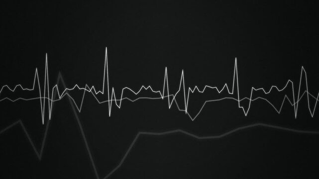 Overlapping jagged line graphs scroll in a seamless loop