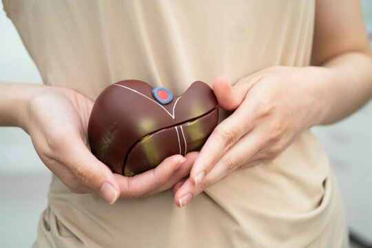Cirrhosis, Liver cancer, fatty liver, Asian women with liver human anatomy model in World Hepatitis Day.