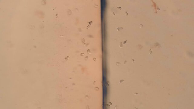 Motile Protozoa Cells Swimming Under Light Microscope