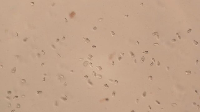 Motile Protozoa Cells Swimming Under Light Microscope