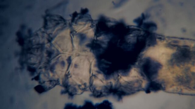 Demodex Mite Elongated Body Segments Microscopic View Human Skin