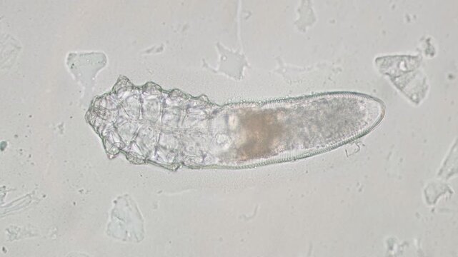 Demodex Mite Elongated Body Segments Microscopic View Human Skin