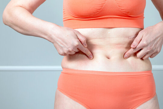 Woman pointing at belly showing bloating digestion problems, stomach pain or abdominal health